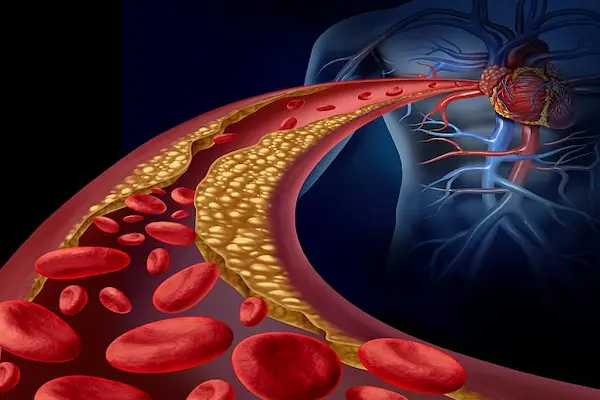 B7-33 Reduce Heart Inflammation