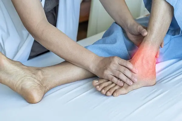 BPC-157 Peptide Therapy Help Tendon Injuries