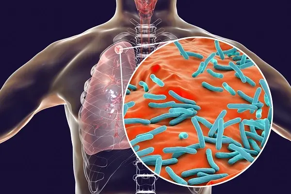 Can Stem Cells Fix Damaged Tissue