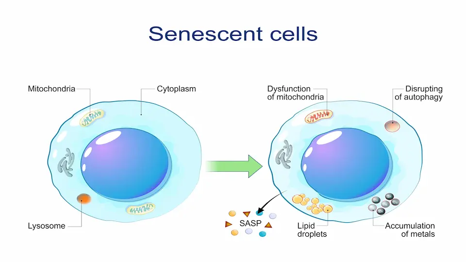 Inflammation From Senescent Cells Impact Aging