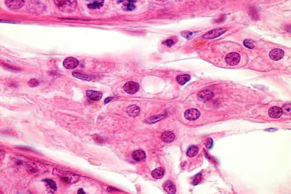 Leydig cell 