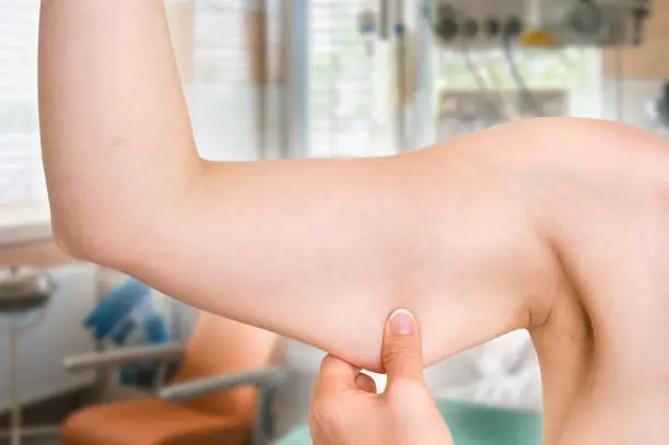 Myostatin Supplements Help Prevent Muscle Loss