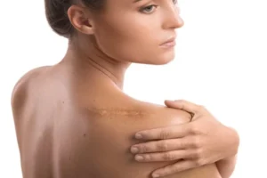 Best Tissue Repair Peptides