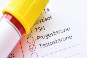 Does Kisspeptin hormone Increase Testosterone