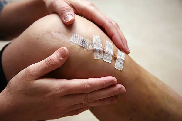 BPC-157 Help With Tissue Healing