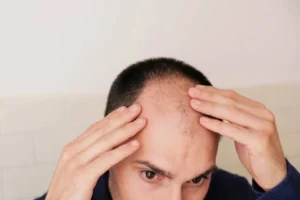 PTD-DBM Hair Growth Peptide