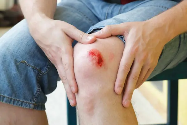 Cell Repair Support Tissue Healing