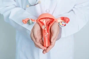 Endometriosis Peptide Therapy