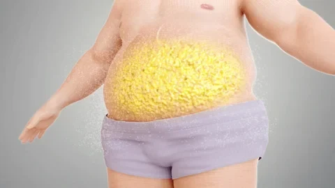Visceral Fat