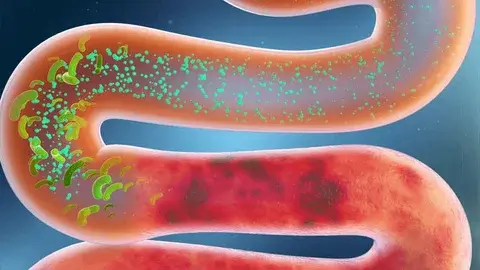 Gut Health