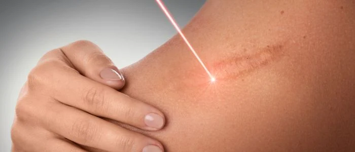 Thymalin Tissue Repair Peptide Therapy