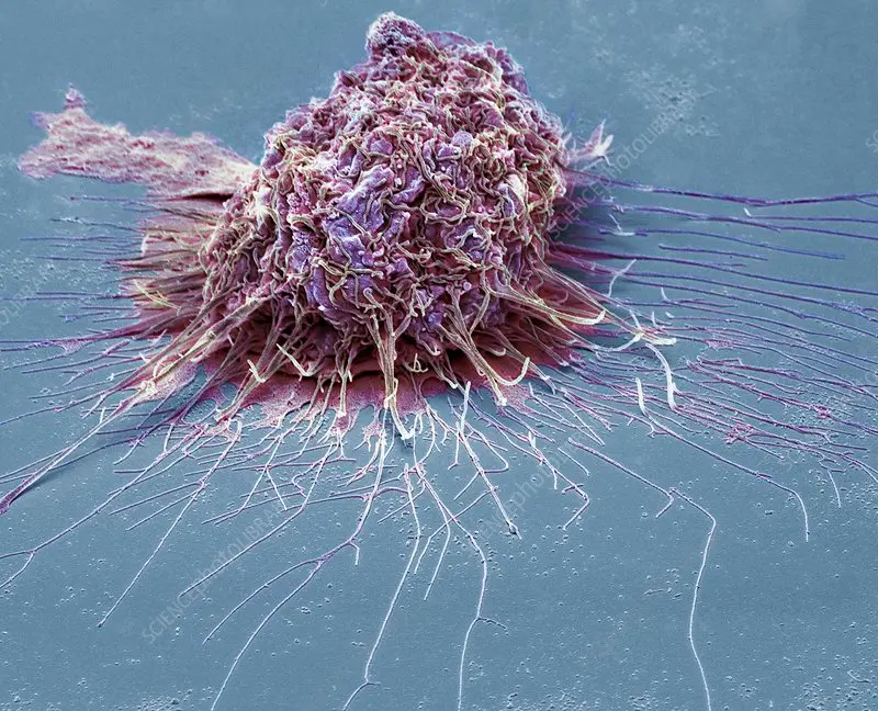 Bronchial cell activity related to lung scarring processes.