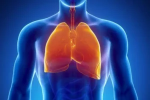 Bronchogen: A Potential Breakthrough for COPD Patients