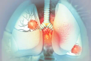 Bronchogen Peptide in Pulmonary Fibrosis Studies