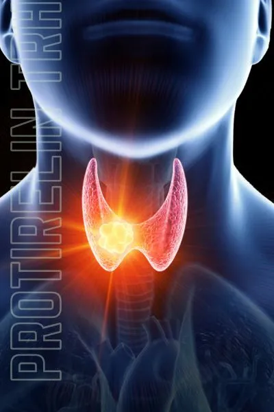 Protirelin TRH FAQs